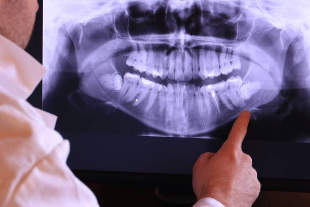 Best Emergency Care for Gum Disease in Home Garden, CA